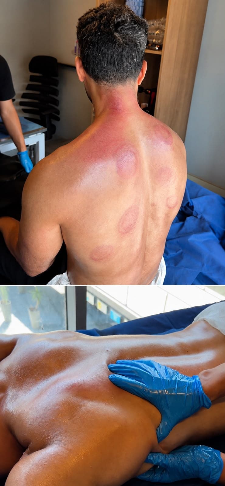 جلسة ريكافري واستشفاء عضلي داخل Oriana Clinic